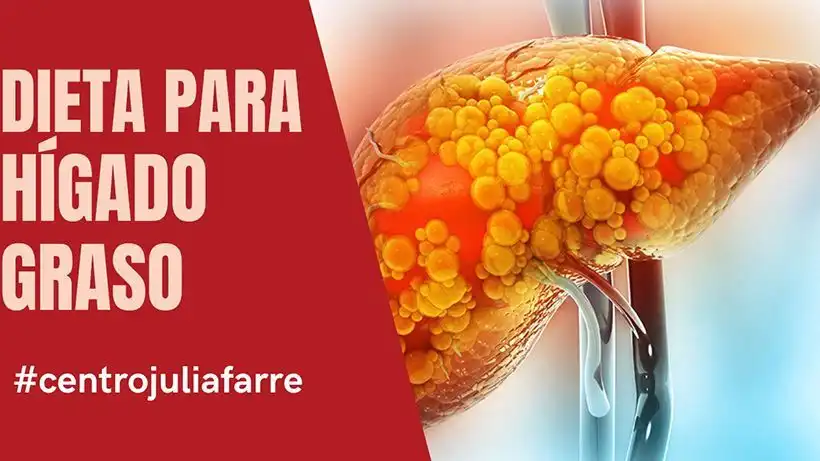 Estrategias Efectivas para Combatir el Hígado Graso y Mejorar la Salud Hepática